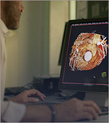 Advanced Coronary Imaging (IVUS/OCT/FFR)