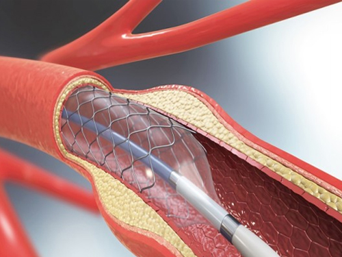 Best Cardiologist in Fortis Hospital Kolkata