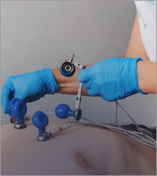 TAVI (Trans Aortic Valve Implantation) & Structural Heart Disease